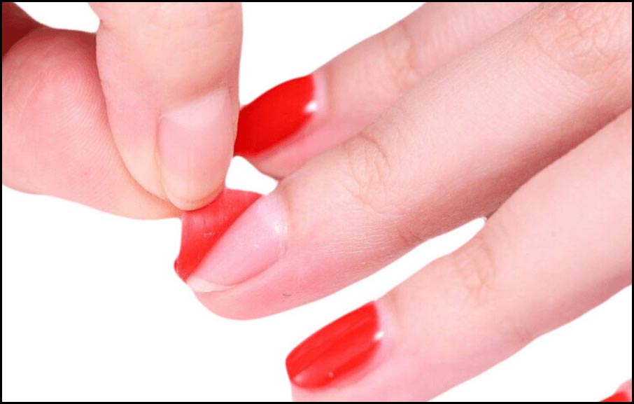 причины полного отслоение гель-лака